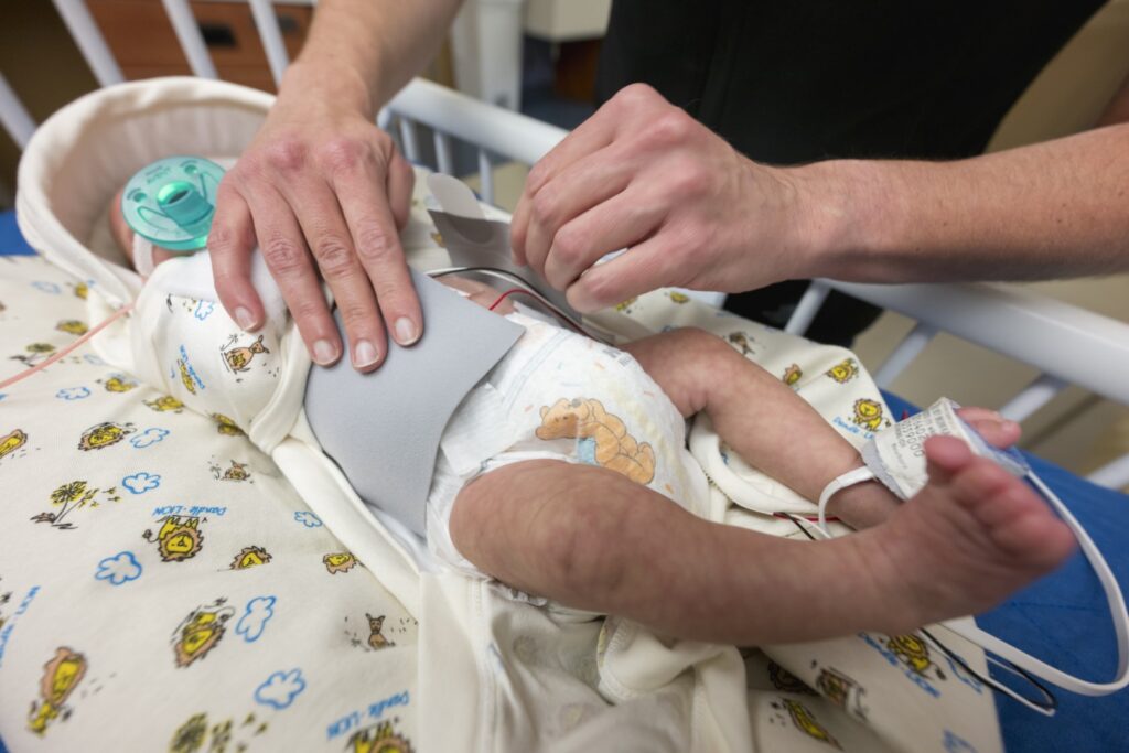 Faja de soporte abdominal NeoBellyBand para recién nacidos